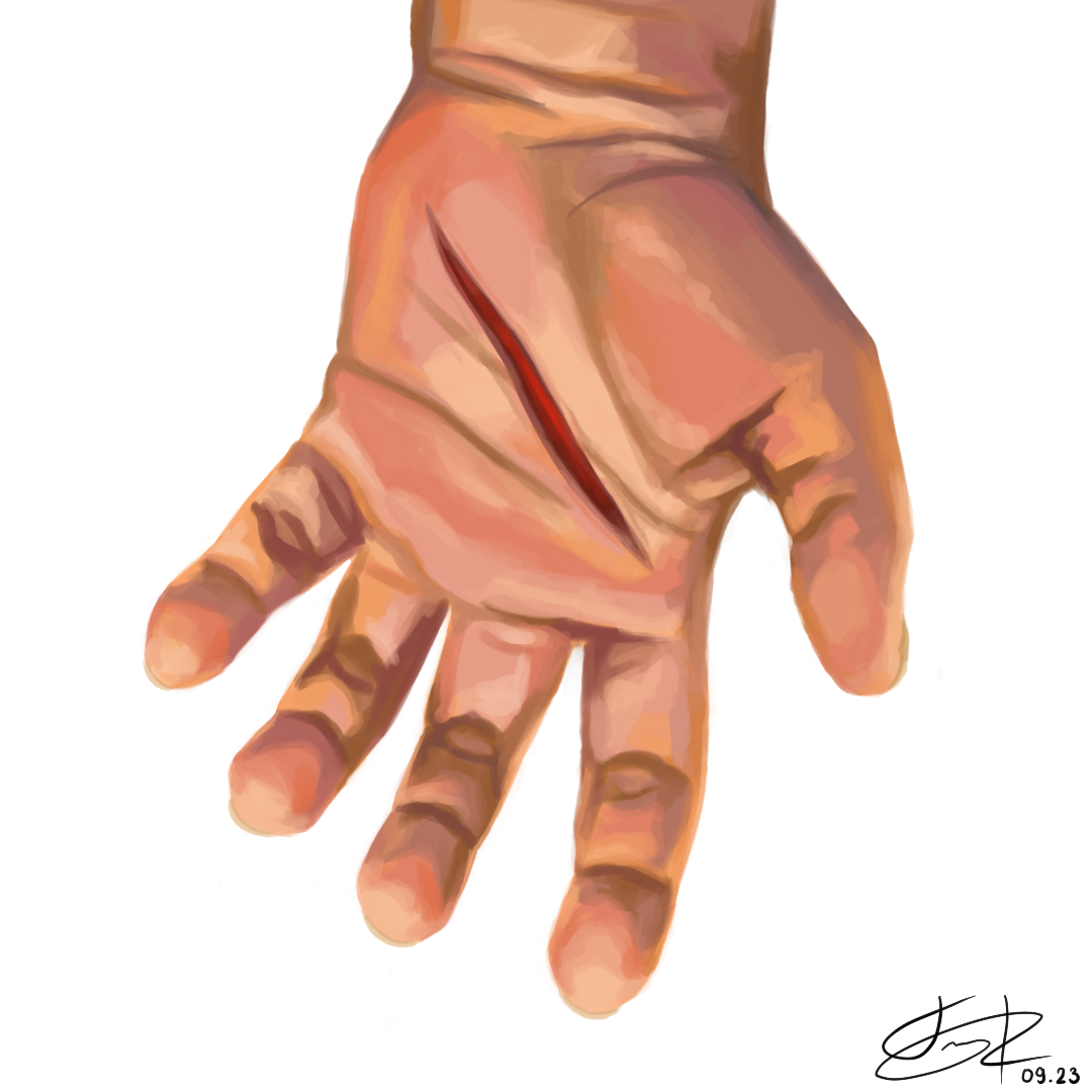 Digital drawing of a hand with a scar in the middle of its palm.